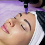 Microneedling